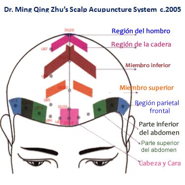 zhu scalp acupuncture pdf